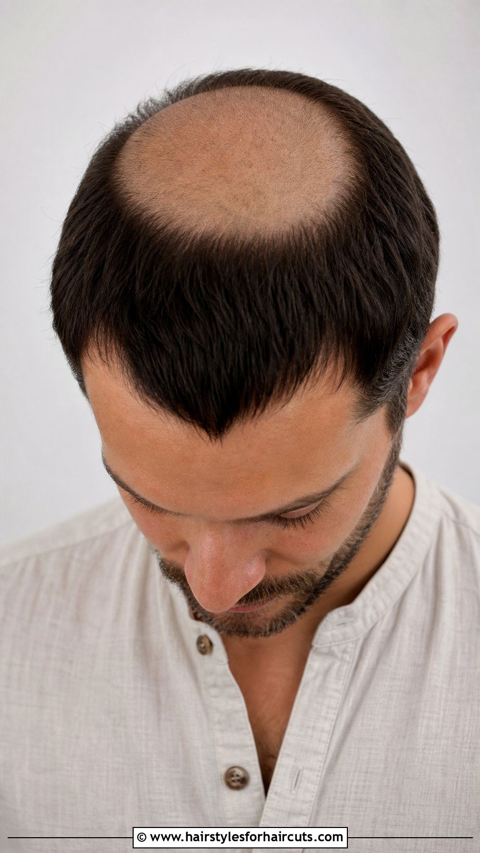 Friar Tuck Tonsure Look - 25 friar tuck haircuts - 25 friar tuck haircuts