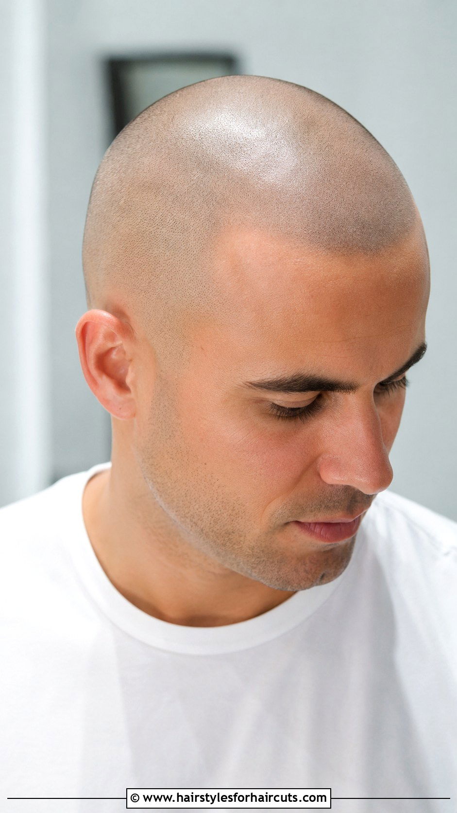 Induction Cut Before Hair Transplant - 25 haircuts before hair transplant - 25 haircuts before hair transplant