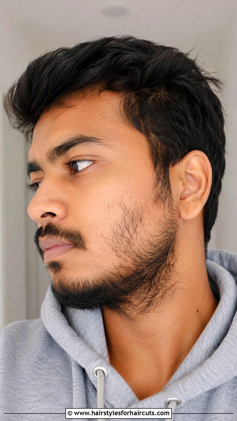 Patchy Beard - 25 worst facial hairstyles - 25 worst facial hairstyles