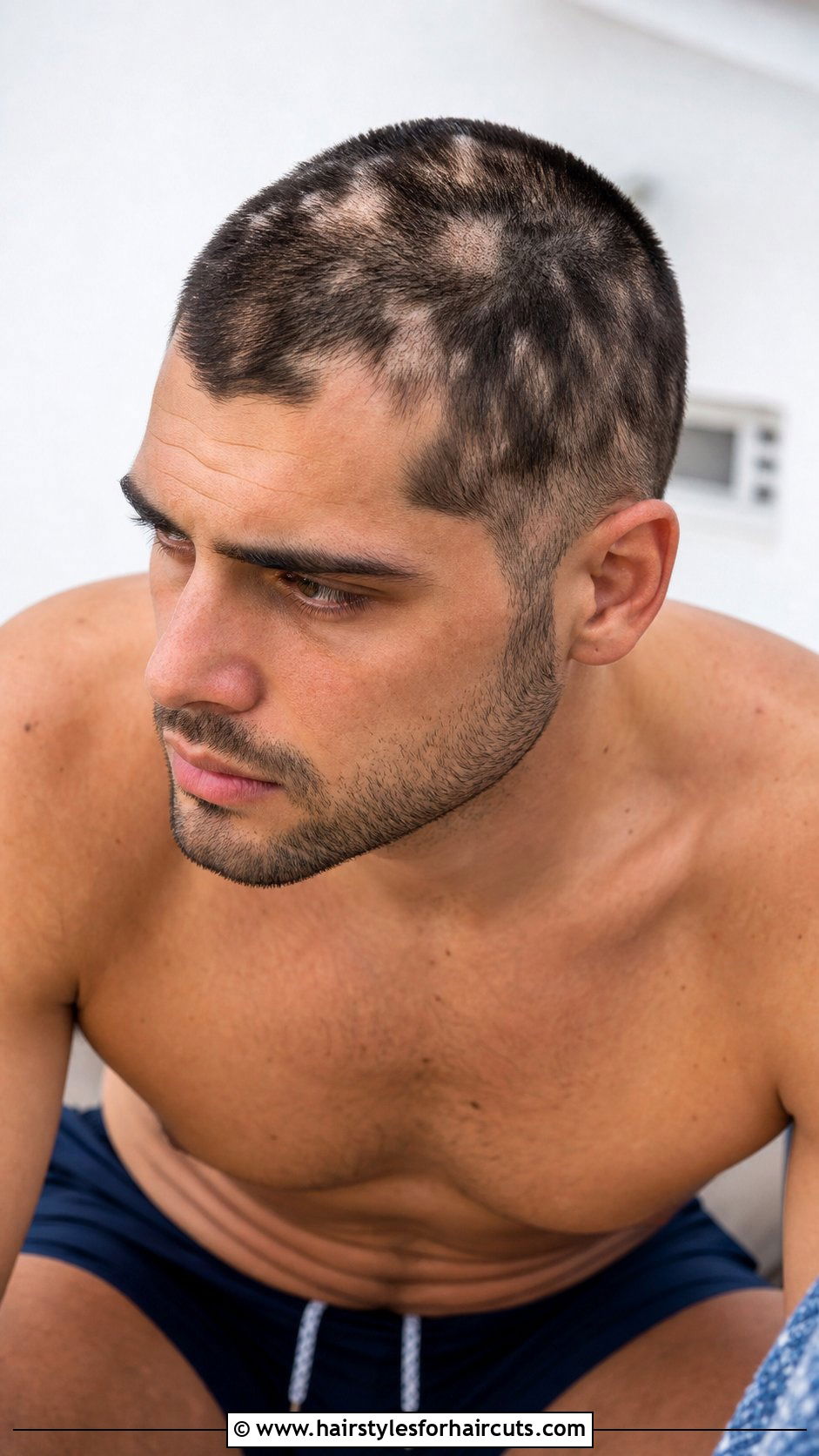Patchy Buzz Cut Haircut - 25 worst funny haircuts - 25 worst funny haircuts