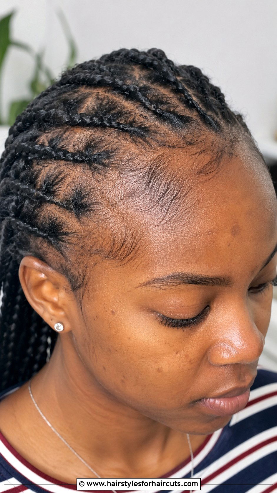 Tight Braids and Cornrows Causing Traction - 25 hair falling out after haircuts - 25 hair falling out after haircuts